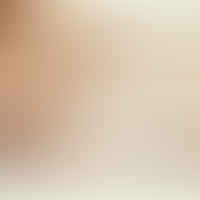Nailing the Natural Look: Discover the Best Nude Nail Designs for Narrow Nails